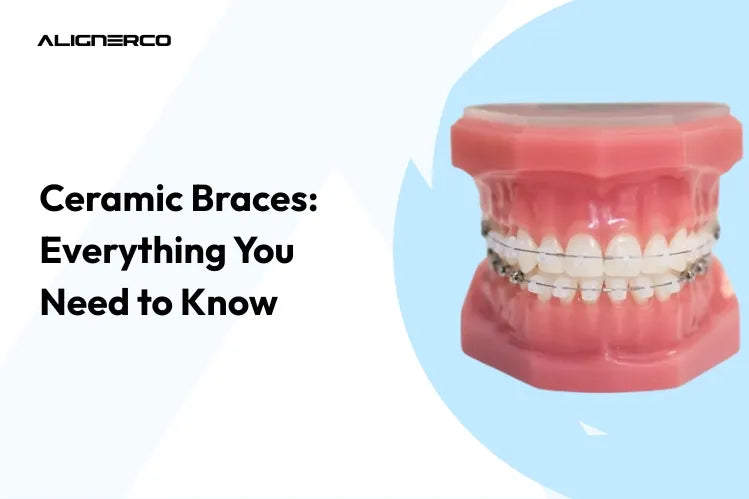 Keramische beugels op een tandmodel