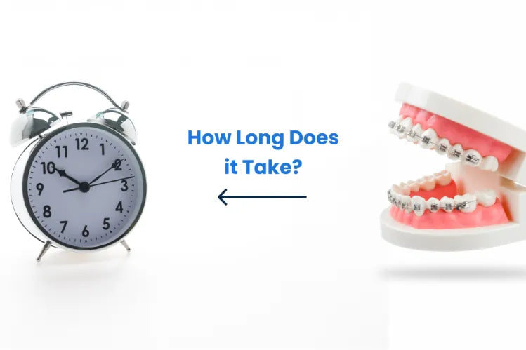 beugel mijn tanden rechtzet