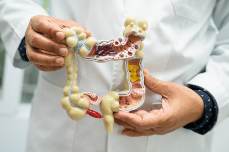 Doctor Holding a Model Illustrating the Digestive System
