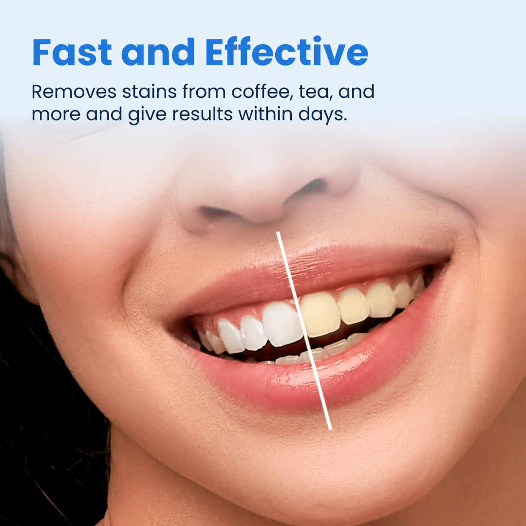 Smart Teeth Whitening Kit